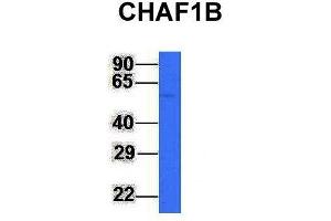 Host:  Rabbit  Target Name:  CHAF1B  Sample Type:  Jurkat  Antibody Dilution:  1.