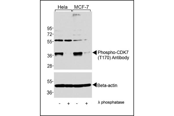 CDK7 antibody  (pThr170)