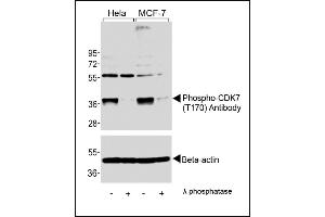 Western blot analysis of extracts from Hela and MCF-7 cells, untreated or lamda phosphatase-treated, using Phospho-CDK7 Antibody (upper) or Beta-actin (lower).