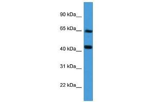 COL8A2 antibody used at 0. (COL8a2 antibody  (Middle Region))