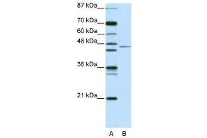 WB Suggested Anti-TRIM14 AntibodyTitration: 2. (TRIM14 antibody  (N-Term))