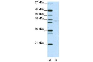 WB Suggested Anti-TRIM14 AntibodyTitration: 2. (TRIM14 antibody  (N-Term))