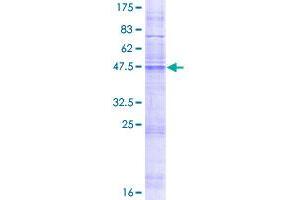 MMD Protein (AA 1-238) (GST tag)