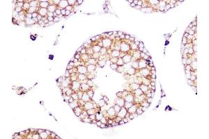 Immunohistochemistry of paraffin-embedded rat testis using Clathrin heavy chain Rabbit mAb (ABIN7266404) at dilution of 1:100 (40x lens). (Clathrin Heavy Chain (CLTC) antibody)