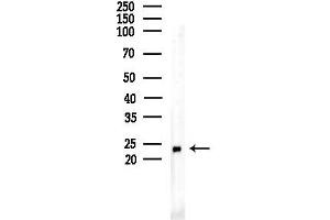 anti-MOB1, Mps One Binder Kinase Activator-Like 1B (MOBKL1B) (N-Term) antibody