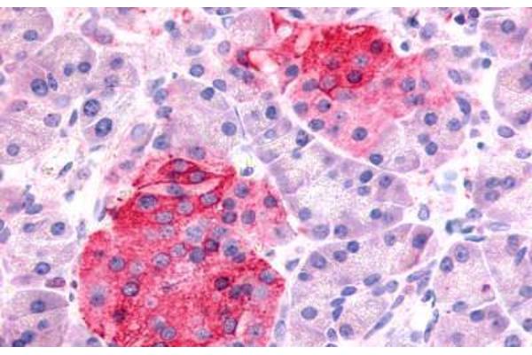 SSTR1 antibody  (N-Term)