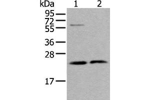 Western blot analysis of LO2 cell and Human testis tissue lysates using ABHD14B Polyclonal Antibody at dilution of 1:350 (ABHD14B antibody)