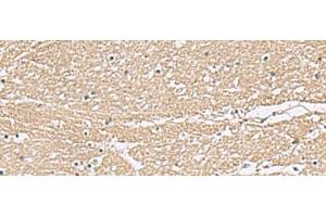 Immunohistochemistry of paraffin-embedded Human brain tissue using KCTD7 Polyclonal Antibody at dilution of 1:55(x200)