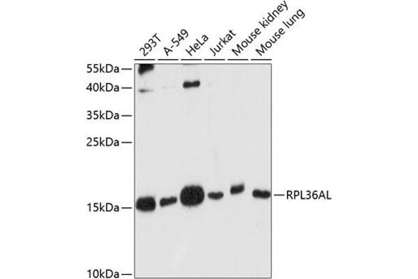 RPL36AL 抗体  (AA 1-106)