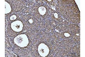 IHC analysis of COX5B using anti-COX5B antibody (ABIN7598975).