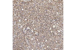 IHC analysis of ACAD9 using anti-ACAD9 antibody (ABIN7602670). (ACAD9 antibody  (AA 92-621))