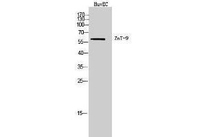 Western Blotting (WB) image for anti-Solute Carrier Family 30 (Zinc Transporter), Member 9 (SLC30A9) (Internal Region) antibody (ABIN3180953) (SLC30A9 antibody  (Internal Region))