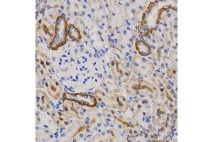 Immunohistochemistry of paraffin-embedded rat kidney using PIBF1 Antibody. (PIBF1 antibody)