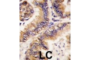 Immunohistochemistry (IHC) image for anti-Trafficking Protein Particle Complex 4 (TRAPPC4) antibody (ABIN2998089)