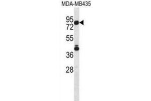 Western Blotting (WB) image for anti-Sphingosine-1-Phosphate Lyase 1 (SGPL1) antibody (ABIN2996917) (SGPL1 antibody)