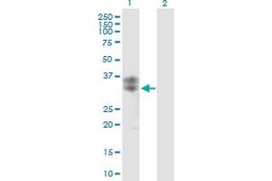 Western Blot analysis of CLEC5A expression in transfected 293T cell line by CLEC5A MaxPab polyclonal antibody. (CLEC5A antibody  (AA 1-188))