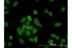 Immunofluorescence of monoclonal antibody to CNAP1 on HeLa cell. (NCAPD2 antibody  (AA 1240-1339))