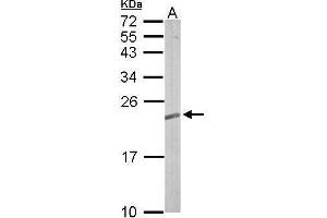 WB Image Sample (50 ug of whole cell lysate) A: mouse brain 12% SDS PAGE antibody diluted at 1:5000 (RRAS2 antibody  (Center))