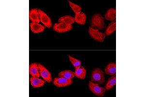 Confocal immunofluorescence analysis of U-2 OS cells using S100 Polyclonal Antibody (ABIN7270129) at dilution of 1:100. (S100A8 antibody  (AA 1-93))