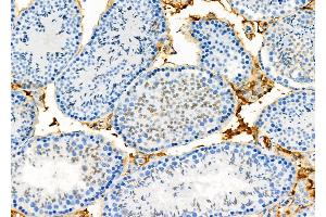ABIN6265772 and ABIN6273336 at 1/100 staining Mouse testis tissue by IHC-P. (TSH receptor antibody  (Internal Region))