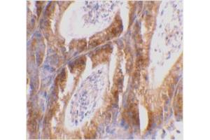 Immunohistochemical staining of mouse testis tissue using Bcl-G antibody at 2 μg/ml. (BCL2L14 antibody  (C-Term))