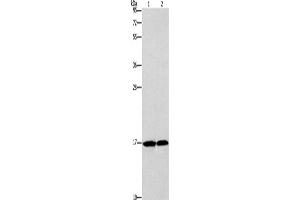 Western Blotting (WB) image for anti-Glia Maturation Factor, gamma (GMFG) antibody (ABIN2422816) (GMFG antibody)