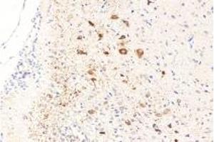 Immunohistochemistry analysis of paraffin-embedded rat brain using RASGRP3 (ABIN7075376) at dilution of 1: 1000 (RASGRP3 antibody)
