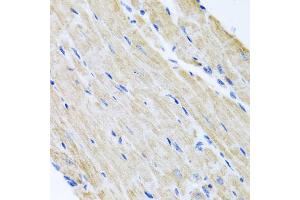 Immunohistochemistry of paraffin-embedded mouse heart using ABCB8 antibody. (ABCB8 antibody)