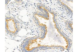 ABIN6264578 and ABIN6272979 at 1/100 staining Human normal tissues adjacent to breast cancer by IHC-P.