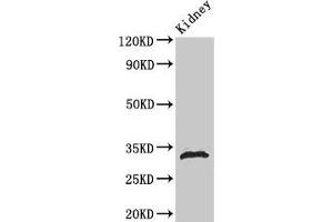 Western Blot Positive WB detected in: Rat kidney tissue All lanes: HIST1H1B antibody at 1 μg/mL Secondary Goat polyclonal to rabbit IgG at 1/50000 dilution Predicted band size: 23 kDa Observed band size: 32 kDa