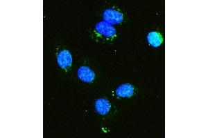 IF analysis of Hexokinase 1/HK1 using anti-Hexokinase 1/HK1 antibody (ABIN7600259). (Hexokinase 1 antibody  (AA 17-323))