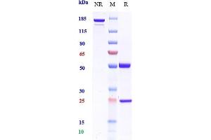 Anti-CSF2 / GM-CSF Reference Antibody (namilumab) on SDS-PAGE under reducing (R) condition. (Recombinant CSF2 (Namilumab Biosimilar) antibody)