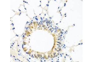Immunohistochemistry of paraffin-embedded Mouse lung using COQ7 Polyclonal Antibody at dilution of 1:100 (40x lens). (Coq7 antibody)