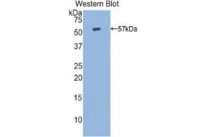 Western Blotting (WB) image for anti-Heat Shock 70kDa Protein 14 (HSPA14) (AA 1-509) antibody (ABIN1859210)