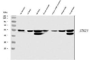 Western blot analysis of MST3/STK24 using anti-MST3/STK24 antibody (ABIN7599389). (STK24 antibody  (AA 1-433))