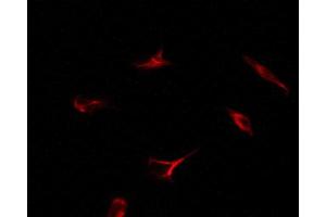 ABIN6269080 staining 293 by IF/ICC. (Estrogen Receptor alpha antibody  (C-Term))