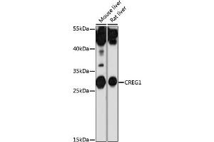 Western blot analysis of extracts of various cell lines, using CREG1 antibody (ABIN7266268) at 1:1000 dilution. (CREG1 antibody  (AA 110-190))