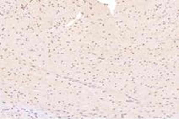 ZNF154 antibody