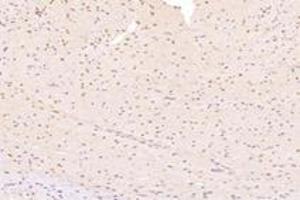 Immunohistochemistry analysis of paraffin-embedded ratheartusing,ZNF154 (ABIN7076261) at dilution of 1:4000