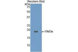 Western Blotting (WB) image for anti-Lysophosphatidylcholine Acyltransferase 3 (LPCAT3) (AA 122-233) antibody (ABIN1176546) (LPCAT3 antibody  (AA 122-233))