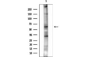 Western blot analysis of lysates from HepG2 cells, using n-Myc Mouse Monoclonal Antibody at 1/1000 dilution.