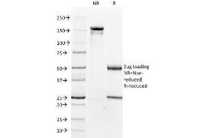 SDS-PAGE Analysis Purified Smooth Muscle Actin Mouse Monoclonal Antibody (1A4).