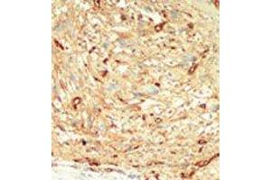 Image no. 1 for anti-serine/threonine Kinase 4 (STK4) (C-Term) antibody (ABIN360312) (STK4 antibody  (C-Term))