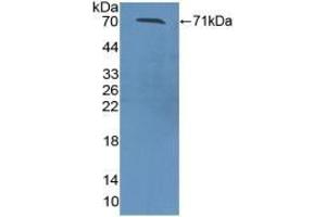 Detection of Recombinant ZPI, Mouse using Polyclonal Antibody to Serpin A10 (SERPINA10) (SERPINA10 antibody  (AA 22-448))