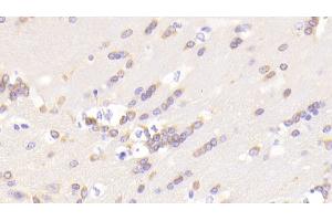 Detection of LRDD in Mouse Cerebrum Tissue using Polyclonal Antibody to Leucine Rich Repeats And Death Domain Containing Protein (LRDD) (Leucine Rich Repeats And Death Domain Containing Protein (AA 666-915) antibody)