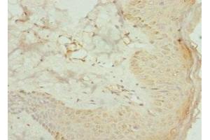 Immunohistochemistry of paraffin-embedded human skin tissue using ABIN7142022 at dilution of 1:100 (AGPAT2 antibody  (AA 199-278))