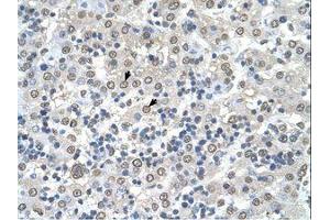 Image no. 1 for anti-Cerebellar Degeneration-Related Protein 2, 62kDa (CDR2) (N-Term) antibody (ABIN321833) (CDR2 antibody  (N-Term))