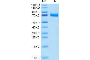 CD36 Protein (CD36) (AA 30-439) (His tag)