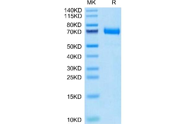 CD36 Protein (CD36) (AA 30-439) (His tag)