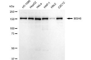 Western blotting analysis using MSH6 antibody (ABIN7799500).